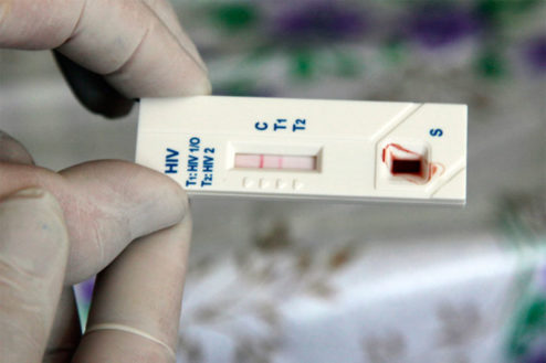 Test rápido de VIH