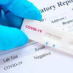 Sanidad habría repartido 1,4 millones de test de detección de anticuerpos a las CCAA en la última semana