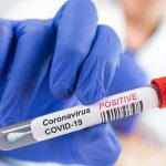 Pacientes con VIH tratados con tenofovir/emtricitabina podrían ser menos sensibles al coronavirus