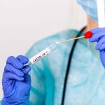España alcanza los 23,5 millones de pruebas diagnósticas desde el inicio de la epidemia de covid-19