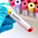 Sanidad reitera su compromiso de eliminación de la hepatitis C para 2030