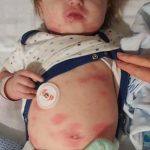 La AEP se adhiere al manifiesto ‘Derrotar a la meningitis para 2030’