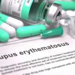 ‘VitaLES’ una apuesta para medir el lupus sistémico eritematoso