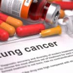 El GECP critica el retraso en España de nuevos fármacos para el cáncer de pulmón