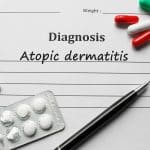 La SEFH lanza la ‘Guía de práctica farmacéutica en dermatitis atópica’