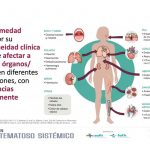 Fármacos biológicos abren una puerta de futuro frente al Lupus Eritematoso Sistémico