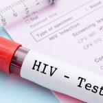 La farmacia comunitaria, el medio más accesible para la detección precoz del VIH
