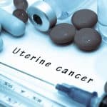 Los iPARP, un cambio de paradigma en los tratamientos del cáncer de ovario