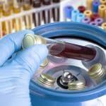 Una estrategia de diagnóstico y tratamiento de VIH en un día suprime el virus en el 97% de los casos