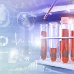 Nuevos ensayos clínicos preparan una respuesta más eficaz al linfoma