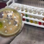 ECDC: Europa no está en camino de cumplir 4 de los 5 objetivos RAM previstos para 2030