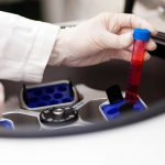 Datos relevantes para el primer fármaco que reduce la actividad de la enfermedad de Sjögren