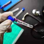 El ECDC sitúa en muy bajo el riesgo del virus Nipah para europeos tras los casos en India