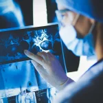 Prevención, cribado, diagnóstico precoz y preciso y equidad: la ruta hacia ‘cAncer Zero’