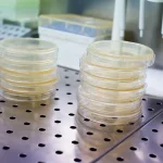 La Fe y el Clínic inician un ensayo clínico pionero con una CAR-T dirigida a leucemias agudas