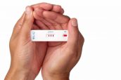 Rapid HIV test