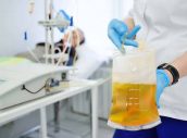 the procedure of purification of blood and plasma from toxins