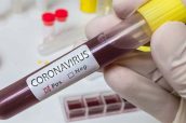 Coronavirus - positivo