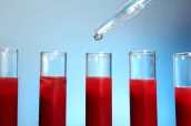 Test tubes filled with blood and glass dropper on blue blurred b