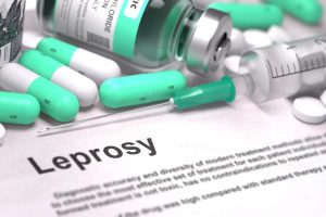 Depositphotos_88342220_XL