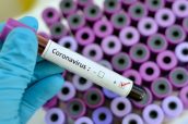 Imagen de una muestra con positivo en coronavirus. (Foto: Farmaindustria)