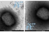 Imagen del Monkey Pox por microscopia electrónica del ISCIII