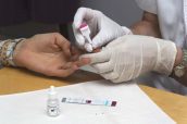 Imagen de la realización de un test rápido de VIH en farmacia.