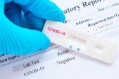 Test rapidos codiv-19 coronavirus serológicos