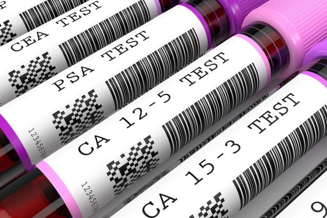 3d render of  blood samples with tumor markers test