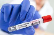 coronavirus - covid19 positivo