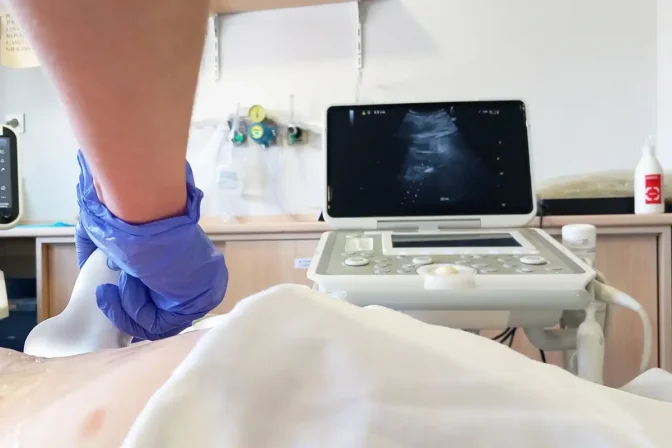 ecografía aparato digestivo