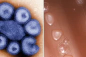 Imágenes al microscopio del virus de la gripe y de la bacteria causante de la neumonía.